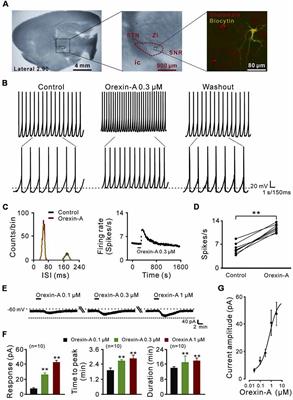 Ionic Mechanisms Underlying the Excitatory Effect of Orexin on Rat Subthalamic Nucleus Neurons